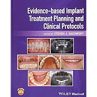 Evidence-based Implant Treatment Planning and Clinical Protocols Evidence-based Implant Treatment Planning and Clinical Protocols Hardcover Kindle