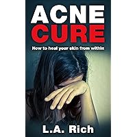 Acne Cure: How to heal your skin from within Acne Cure: How to heal your skin from within Kindle