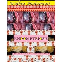 ENDOMETRIOSIS: A Smart Guide to Better Reproductive Health ENDOMETRIOSIS: A Smart Guide to Better Reproductive Health Kindle