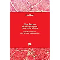Liver Tumors: Epidemiology, Diagnosis, Prevention and Treatment