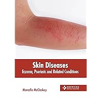 Skin Diseases: Eczema, Psoriasis and Related Conditions