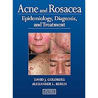 Acne and Rosacea: Epidemiology, Diagnosis and Treatment Acne and Rosacea: Epidemiology, Diagnosis and Treatment Kindle Hardcover Paperback