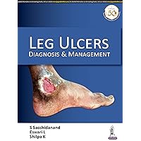 Leg Ulcers: Diagnosis and Management: Diagnosis & Management Leg Ulcers: Diagnosis and Management: Diagnosis & Management Kindle Paperback