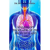 Malignant Neoplasm of the Bronchus and Lung (Medical care and health) Malignant Neoplasm of the Bronchus and Lung (Medical care and health) Kindle Paperback
