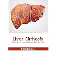 Liver Cirrhosis: Diagnosis, Medication and Treatment