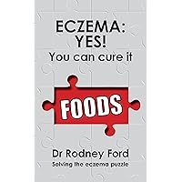 Eczema: Yes! You Can Cure It: Foods – the missing piece. 10 steps to solve the eczema puzzle.
