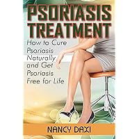 Psoriasis Treatment: How to Cure Psoriasis Naturally And Get Psoriasis-Free For Life (Psoriasis, Psoriasis free for life, Psoriasis Cure, Psoriasis Diet, ... Remedies For Psoriasis,Healing Psoriasis)