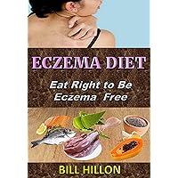ECZEMA DIET: Eat Right to Be Eczema Free ECZEMA DIET: Eat Right to Be Eczema Free Kindle Paperback