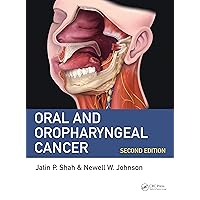 Oral and Oropharyngeal Cancer Oral and Oropharyngeal Cancer Kindle Hardcover Paperback