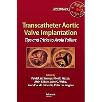 Transcatheter Aortic Valve Implantation: Tips and Tricks to Avoid Failure Transcatheter Aortic Valve Implantation: Tips and Tricks to Avoid Failure Kindle Hardcover