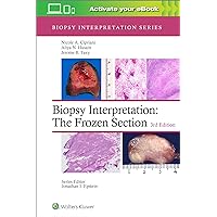 Biopsy Interpretation: The Frozen Section: Print + eBook with Multimedia (Biopsy Interpretation Series) Biopsy Interpretation: The Frozen Section: Print + eBook with Multimedia (Biopsy Interpretation Series) Hardcover Kindle