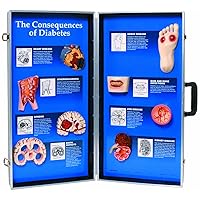 HEALTH EDCO W43081 Consequences of High Blood Pressure 3D Display, 28