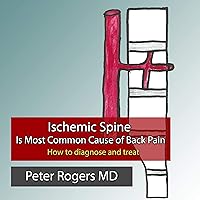 Ischemic Spine Is Most Common Cause of Back Pain: How to Diagnose and Treat Ischemic Spine Is Most Common Cause of Back Pain: How to Diagnose and Treat Audible Audiobook Paperback