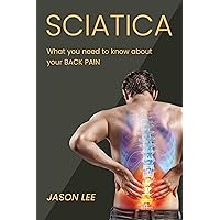 SCIATICA: What You Need to Know About Your Back Pain: A Book on Sciatica, Causes and Symptoms of Sciatica, Treatment Methods and Exercises for Sciatica SCIATICA: What You Need to Know About Your Back Pain: A Book on Sciatica, Causes and Symptoms of Sciatica, Treatment Methods and Exercises for Sciatica Kindle Paperback
