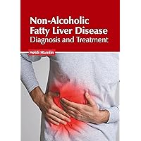 Non-Alcoholic Fatty Liver Disease: Diagnosis and Treatment