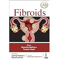 Fibroids Fibroids Kindle Paperback