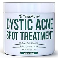 TreeActiv Cystic Acne Spot Treatment, Hormonal & Overnight Sulfur Cystic Treatment For Face, Pimples, and Blemishes for Adults, Men, and Women 120+ Uses (Salicylic Acid Cystic Acne Spot Treatment)