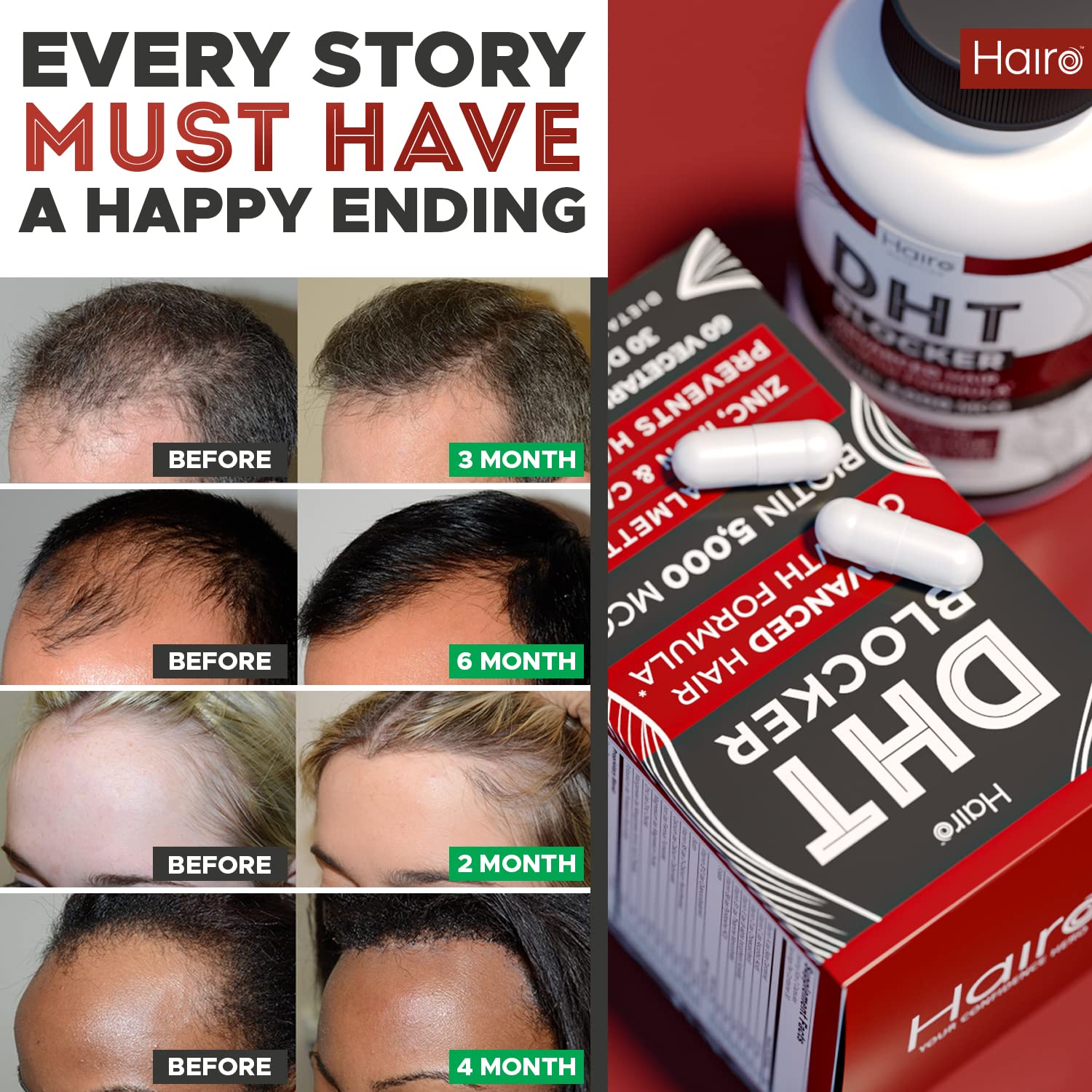 Mua DHT Blocker Hair Growth Supplement - High Potency Biotin & Saw Palmetto  for Hair Regrowth - Natural Hair Loss Treatments for Women & Men - Helps  Stimulate Hair Follicle Growth trên