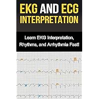 EKG and ECG Interpretation: Learn EKG Interpretation, Rhythms, and Arrhythmia Fast! EKG and ECG Interpretation: Learn EKG Interpretation, Rhythms, and Arrhythmia Fast! Paperback