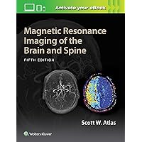 Magnetic Resonance Imaging of the Brain and Spine Magnetic Resonance Imaging of the Brain and Spine Hardcover Kindle