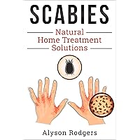 Scabies Natural Home Treatment Solution Scabies Natural Home Treatment Solution Kindle Audible Audiobook Paperback