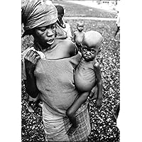 Vintage photo of Save the Children has worked in Ethiopia and educate health professionals about how malnourished children to be treated