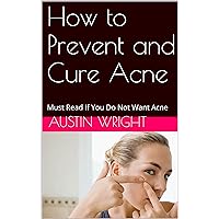 How to Prevent and Cure Acne: Must Read If You Do Not Want Acne