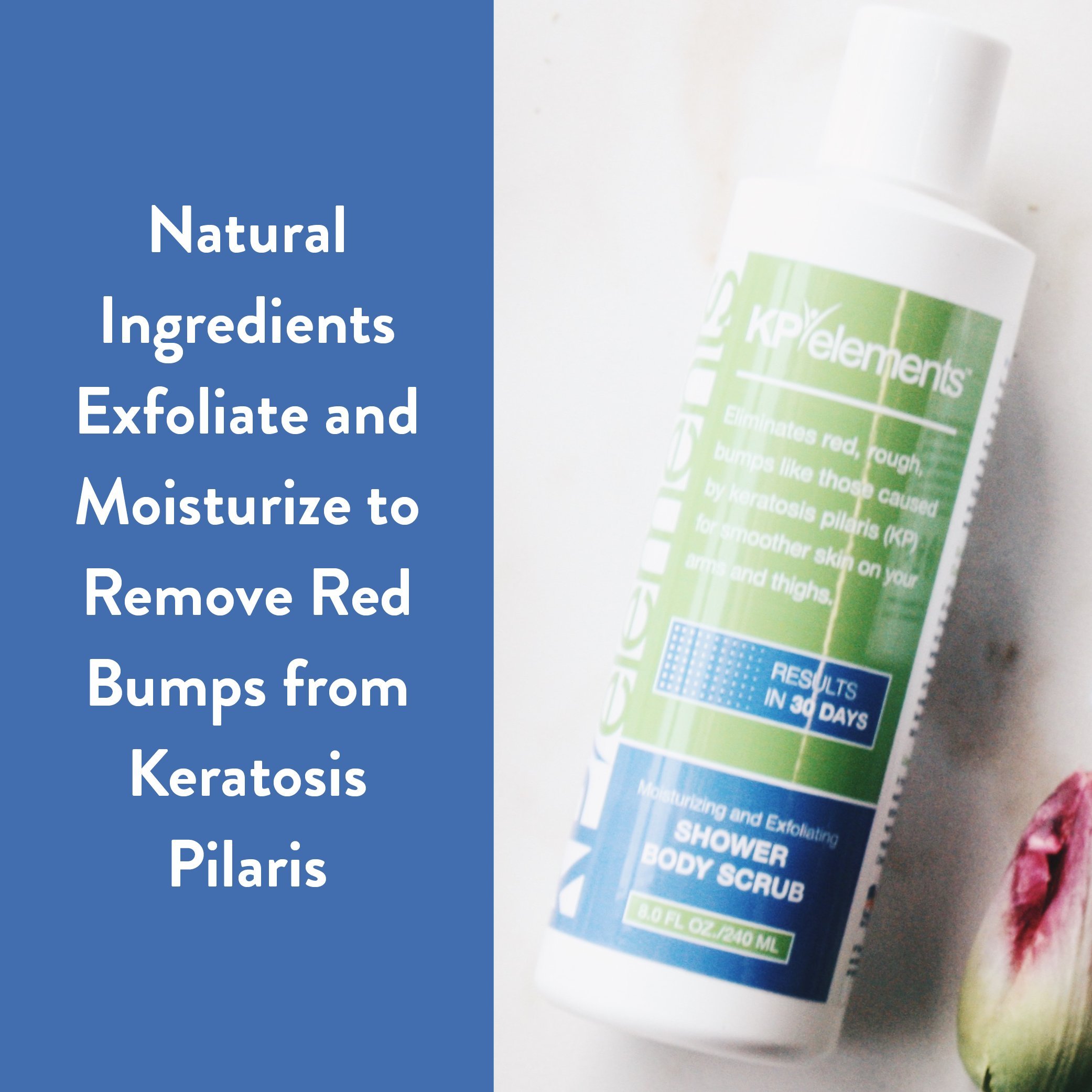 KP Elements Body Scrub and Exfoliating Cream for Keratosis Pilaris Treatment Bundle (8 fl oz) | Bump Eraser Body Scrub | Body Exfoliant for Strawberry Legs