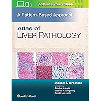 Atlas of Liver Pathology: A Pattern-Based Approach Atlas of Liver Pathology: A Pattern-Based Approach Hardcover Kindle