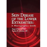 Skin Disease of the Lower Extremities: A Photographic Guide