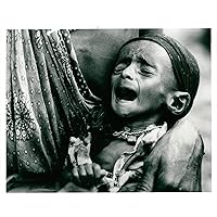 Vintage photo of Somalia39;s portrait of malnourished child.