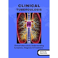 Clinical Tuberculosis : Clinical tuberculosis: Understanding Symptoms, Diagnosis, & Treatment. Clinical Tuberculosis : Clinical tuberculosis: Understanding Symptoms, Diagnosis, & Treatment. Kindle Paperback
