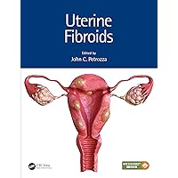 Uterine Fibroids Uterine Fibroids Kindle Hardcover
