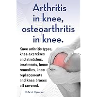 Arthritis in knee, osteoarthritis in knee. Knee arthritis exercises and stretches, treatments, home remedies, knee replacements and knee braces all covered. Arthritis in knee, osteoarthritis in knee. Knee arthritis exercises and stretches, treatments, home remedies, knee replacements and knee braces all covered. Kindle Paperback