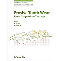 Erosive Tooth Wear: From Diagnosis to Therapy (Monographs in Oral Science Book 25) Erosive Tooth Wear: From Diagnosis to Therapy (Monographs in Oral Science Book 25) Kindle Hardcover