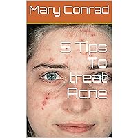 5 Tips To treat Acne
