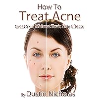 How To Treat Acne - Great Skin Without Toxic Side Effects (Health and Wellness Series Book 1) How To Treat Acne - Great Skin Without Toxic Side Effects (Health and Wellness Series Book 1) Kindle
