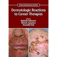 Dermatologic Reactions to Cancer Therapies (Series in Dermatological Treatment) Dermatologic Reactions to Cancer Therapies (Series in Dermatological Treatment) Kindle Hardcover Paperback