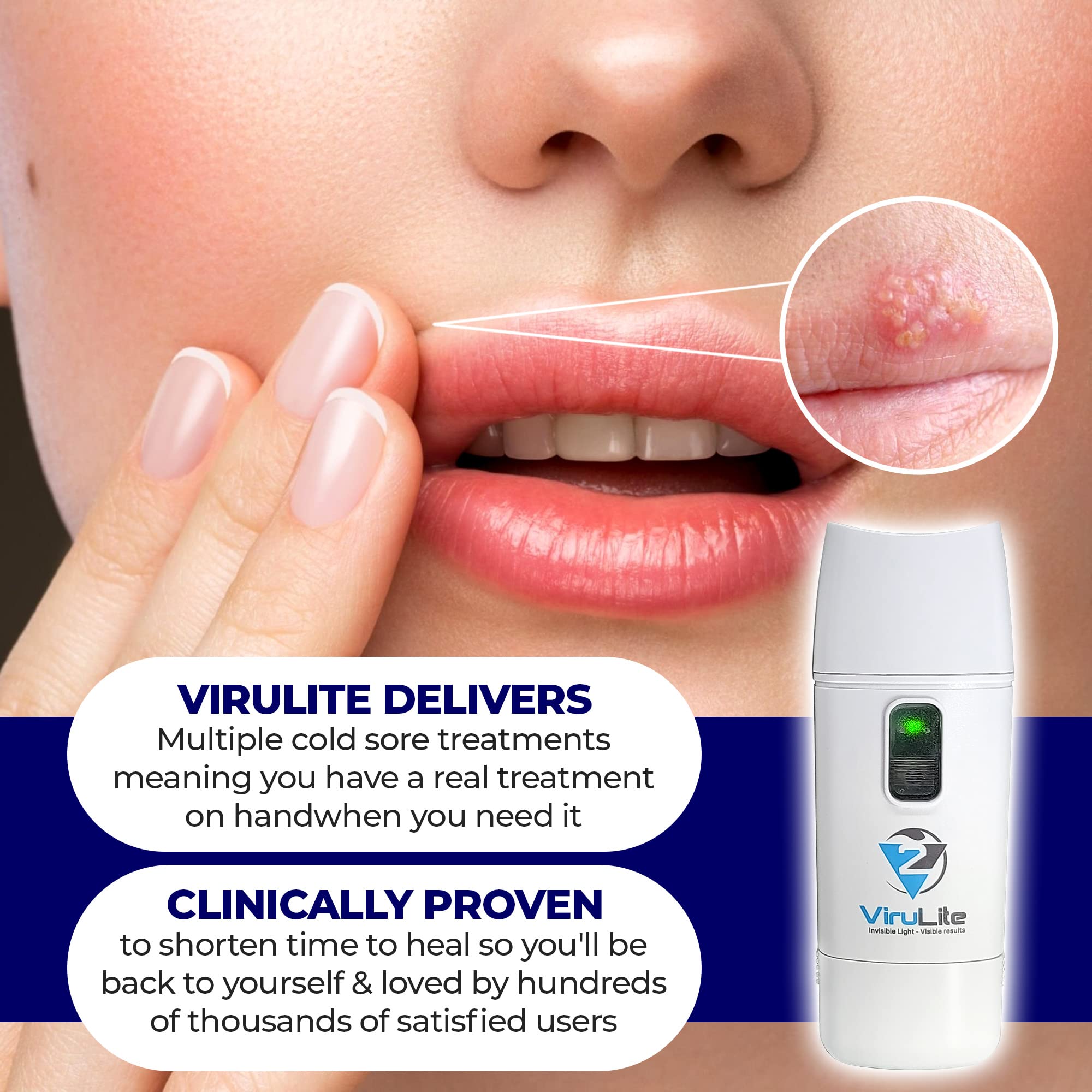 Virulite CS 2.0 Treats Unlimited Outbreaks The First & Only FDA Cleared Mutli-Patented Device for The Treatment of Cold Sores Invisible Light - Visible Results