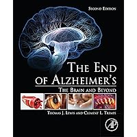 The End of Alzheimer’s: The Brain and Beyond The End of Alzheimer’s: The Brain and Beyond eTextbook Paperback