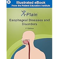 X-Plain ® Esophageal Diseases and Disorders