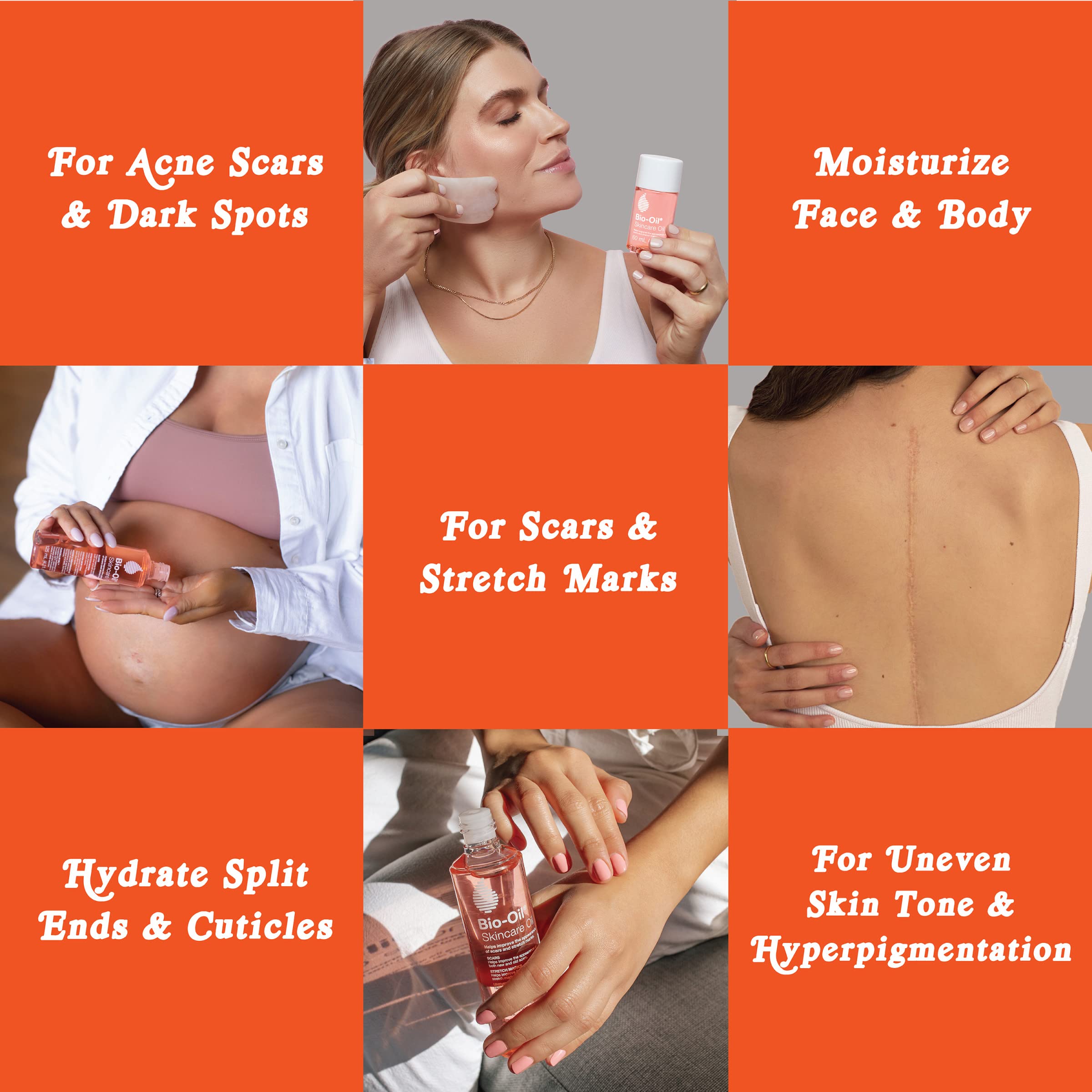 Bio-Oil Skincare Body Oil, Vitamin E, Serum for Scars & Stretchmarks, Face & Body Moisturizer, 2 oz, All Skin Types (Pack of 24)
