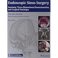 Endoscopic Sinus Surgery Endoscopic Sinus Surgery Hardcover