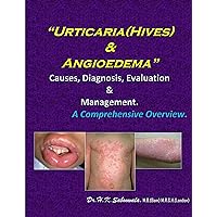 “Urticaria (Hives) & Angioedema”-Causes, Diagnosis, Evaluation & Management. A Comprehensive Overview. “Urticaria (Hives) & Angioedema”-Causes, Diagnosis, Evaluation & Management. A Comprehensive Overview. Kindle