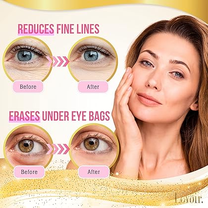 Lovoir 24k Gold Eye Mask (15 Pairs), Under Eye Patches for Puffy Eyes, Dark Circles Under Eye Treatment For Women, Eye Masks For Dark Circles and Puffiness, under eye mask gel eye pads
