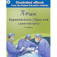X-Plain ® Appendectomy (Open and Laparoscopic)