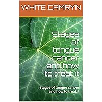 Stages of tongue cancer and how to treat it: Stages of tongue cancer and how to treat it