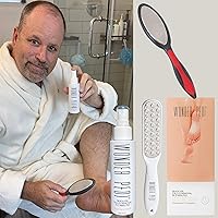 Feet Callus Remover - Instant Exfoliating Peel Foot Spray - Cracked Heels Softener and Double Sided Metal Foot File - Stainless Steel Feet Callus Remover Made in Germany