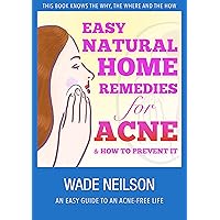 Acne: Easy Natural Home Remedies for Acne & How to Prevent It Acne: Easy Natural Home Remedies for Acne & How to Prevent It Kindle Paperback