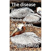 The disease causes permanent bone damage in children: The disease causes permanent bone damage in children